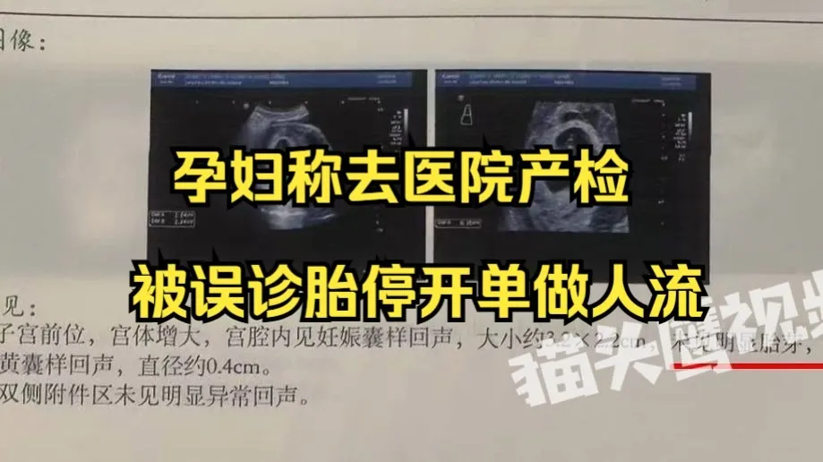 孕妇称产检被误诊胎停医生开单做人流,丈夫:要求复诊,医生说没必要