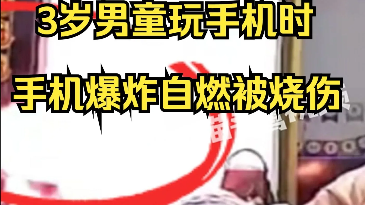 3岁男童玩手机时手机爆炸自燃被烧伤,家属:刚买一年,无任何维修